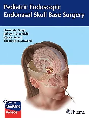 Portada del Libro Pediatric Endoscopic Endonasal Skull Base Surgery de Annand - 9781626235014