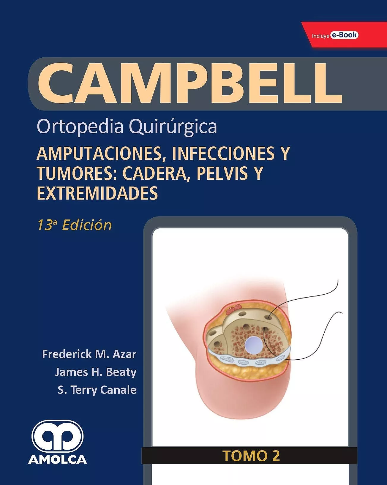 Portada del Libro Campbell Ortopedia Quirurgica (Tomo 2): Amputaciones Infecciones Y Tum de Azar - 9789804300905