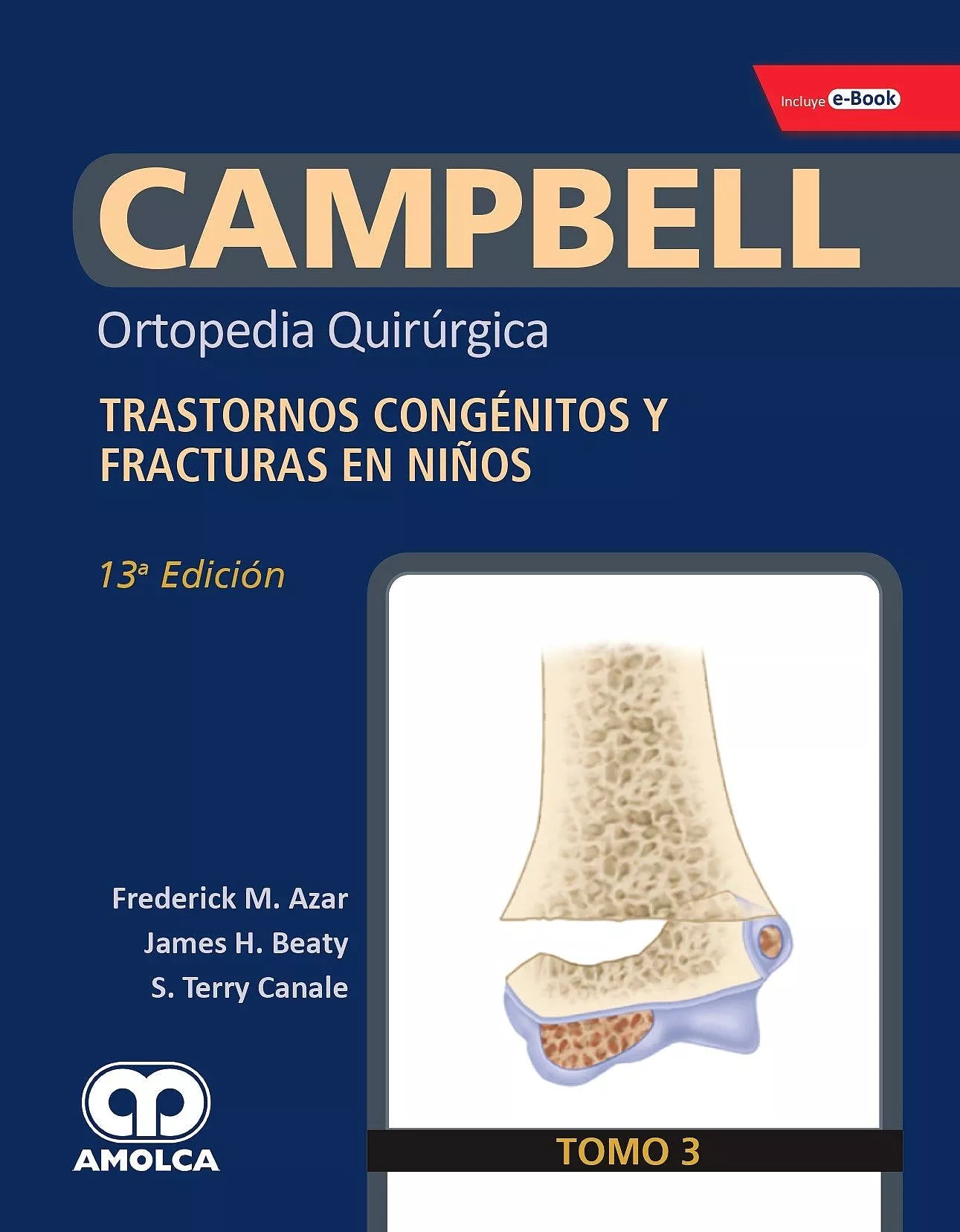 Portada del Libro Campbell Ortopedia Quirurgica (Tomo 3): Trastornos Congenitos Y Fractu de Azar - 9789804300929