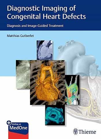 Portada del Libro Diagnostic Imaging Of Congenital Heart Defects. Diagnosis And Image-Gu de B Ingmar Gutberlet - 9783132402515
