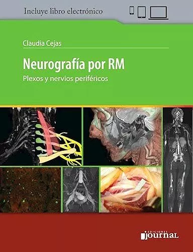 Portada del Libro Neurografia Por Rm. Plexos Y Nervios Perifericos (Libro + E-Book) de C. Cejas - 9789874922403