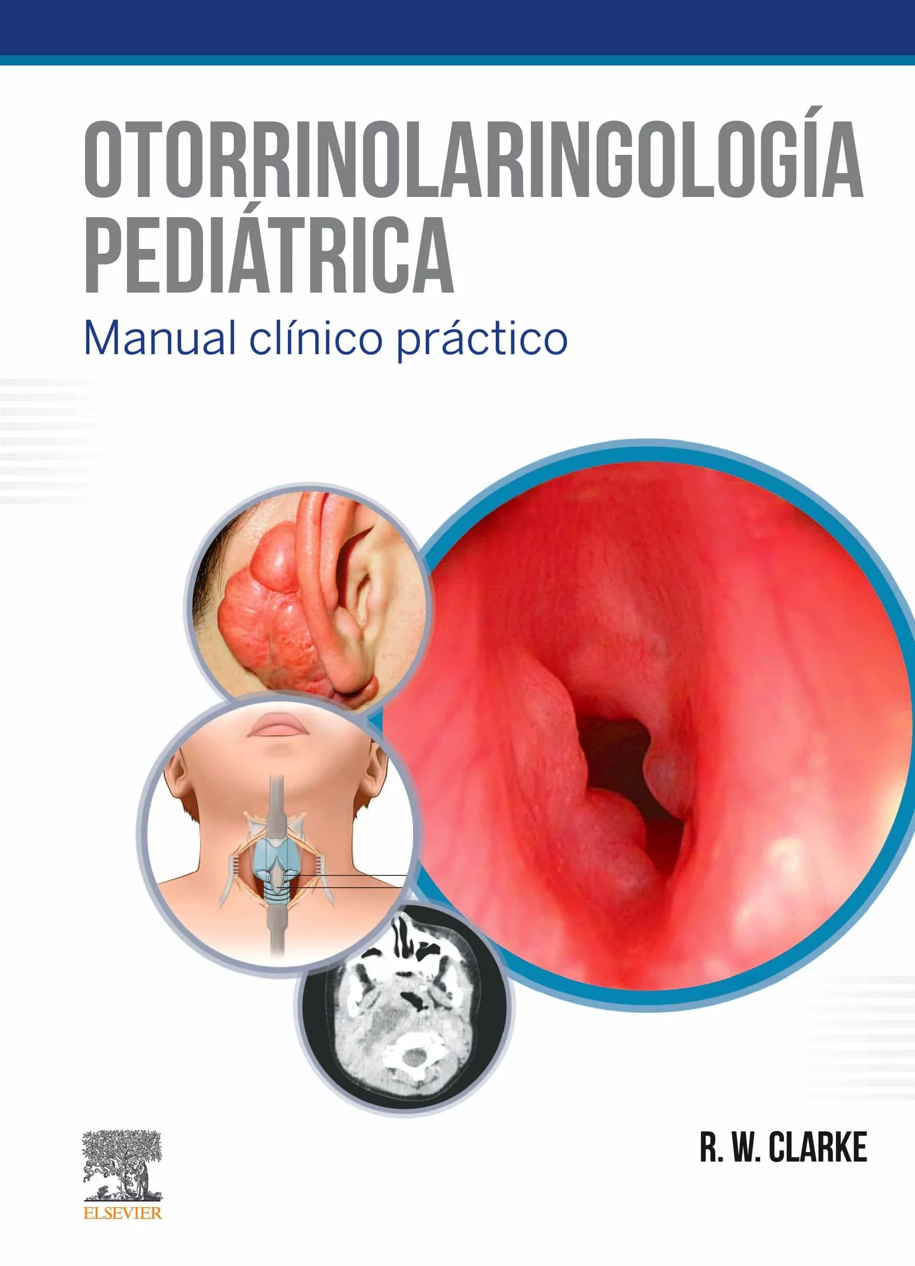 Portada del Libro Otorrinolaringología Pediátrica de Clarke - 9788491135258