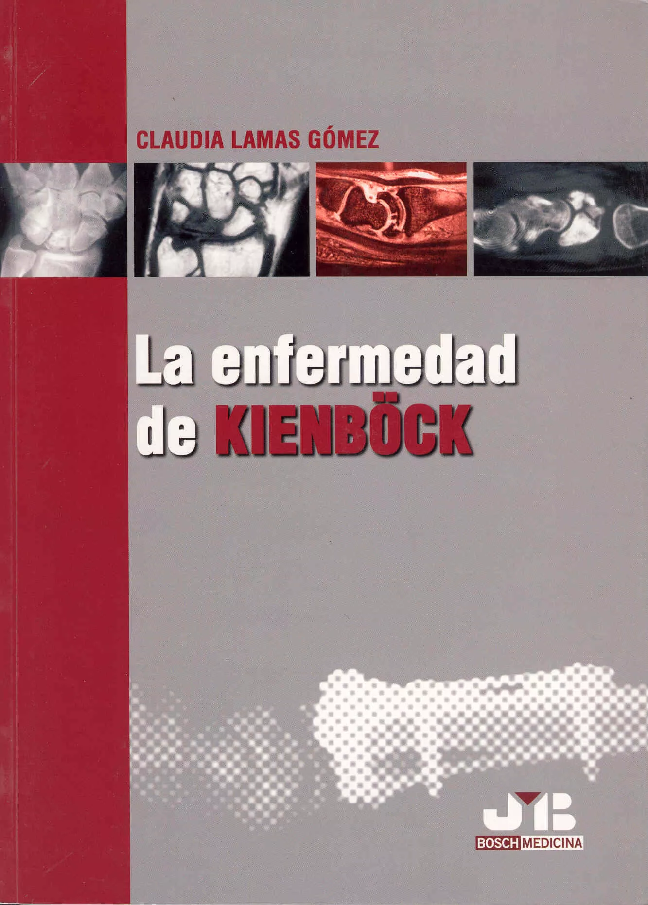 Portada del Libro Enfermedad De Kienböck (Ed. Bilingüe Español-Ingles) de Claudia Lamas Gomez - 9788476987407