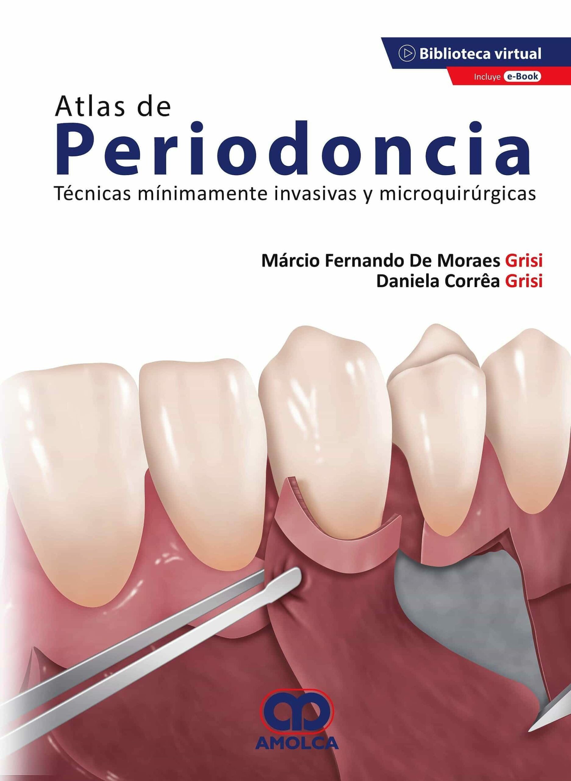 Portada del Libro Atlas De Periodoncia. Tecnicas Minimamente Invasivas Y Microquirurgica de Correa - 9789585598652