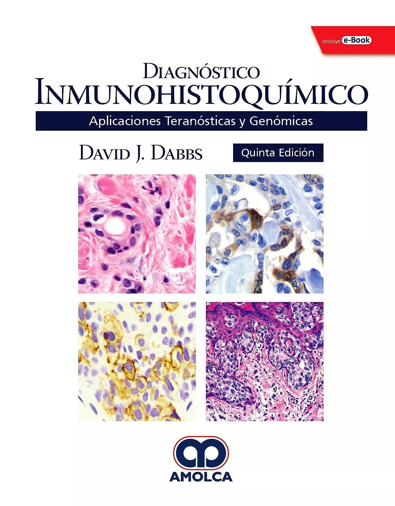 Portada del Libro Diagnostico Inmunohistoquimico. Aplicaciones Teranosticas Y Genominas de Dab S - 9789804300707