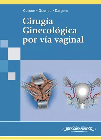 Portada del Libro Cirugia Ginecologica Por Via Vaginal de Daniel Dargent - 9788479039370