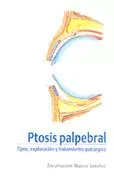 Portada del Libro Ptosis Palpebral: Tipos Exploracion Y Tratamiento Quirurgico de Encarnacion Materos Sanchez - 9788484733164