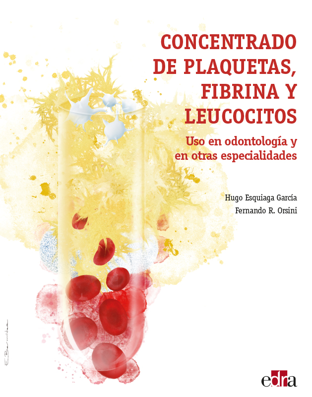 Portada del Libro Concentrado De Plaquetas Fibrina Y Leucocitos. Uso En Odontologia Y En de Fernando Orsini - 9788418020322