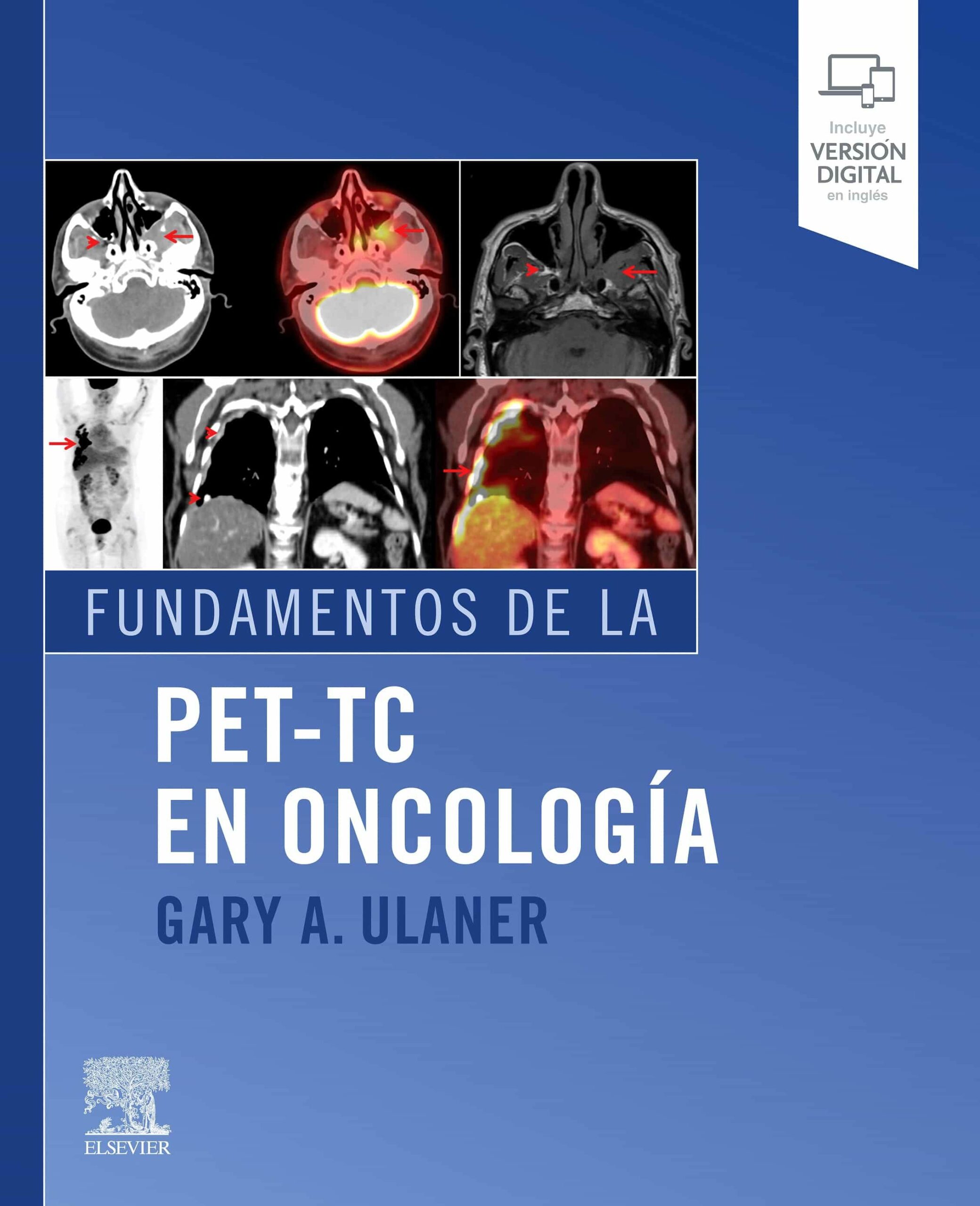Portada del Libro Fundamentos De La Pet-Tc En Oncologia de Gary A. Ulaner - 9788491136736