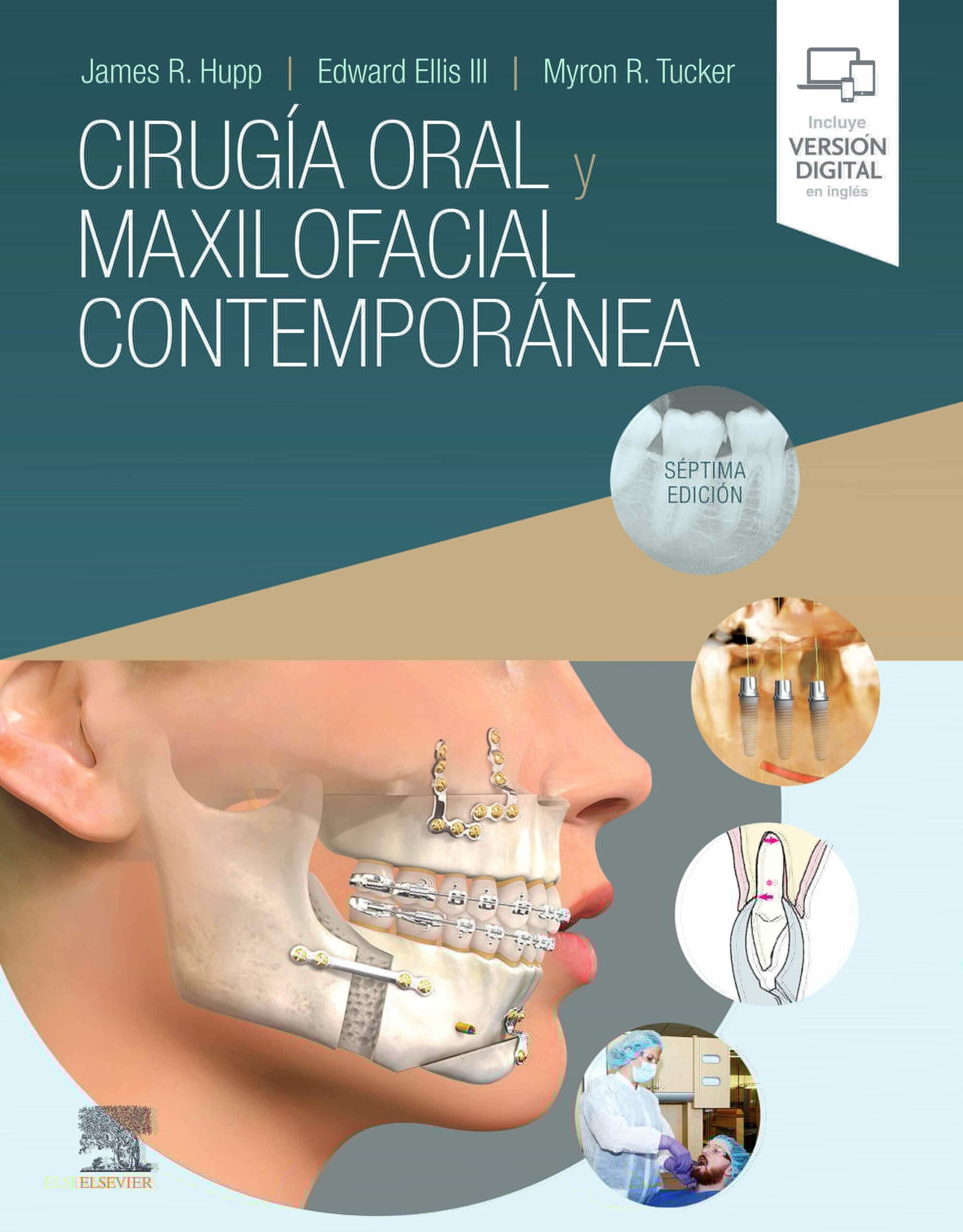 Portada del Libro Cirugia Oral Y Maxilofacial Contemporanea (7ª Ed.) de J. R. Hupp - 9788491136354