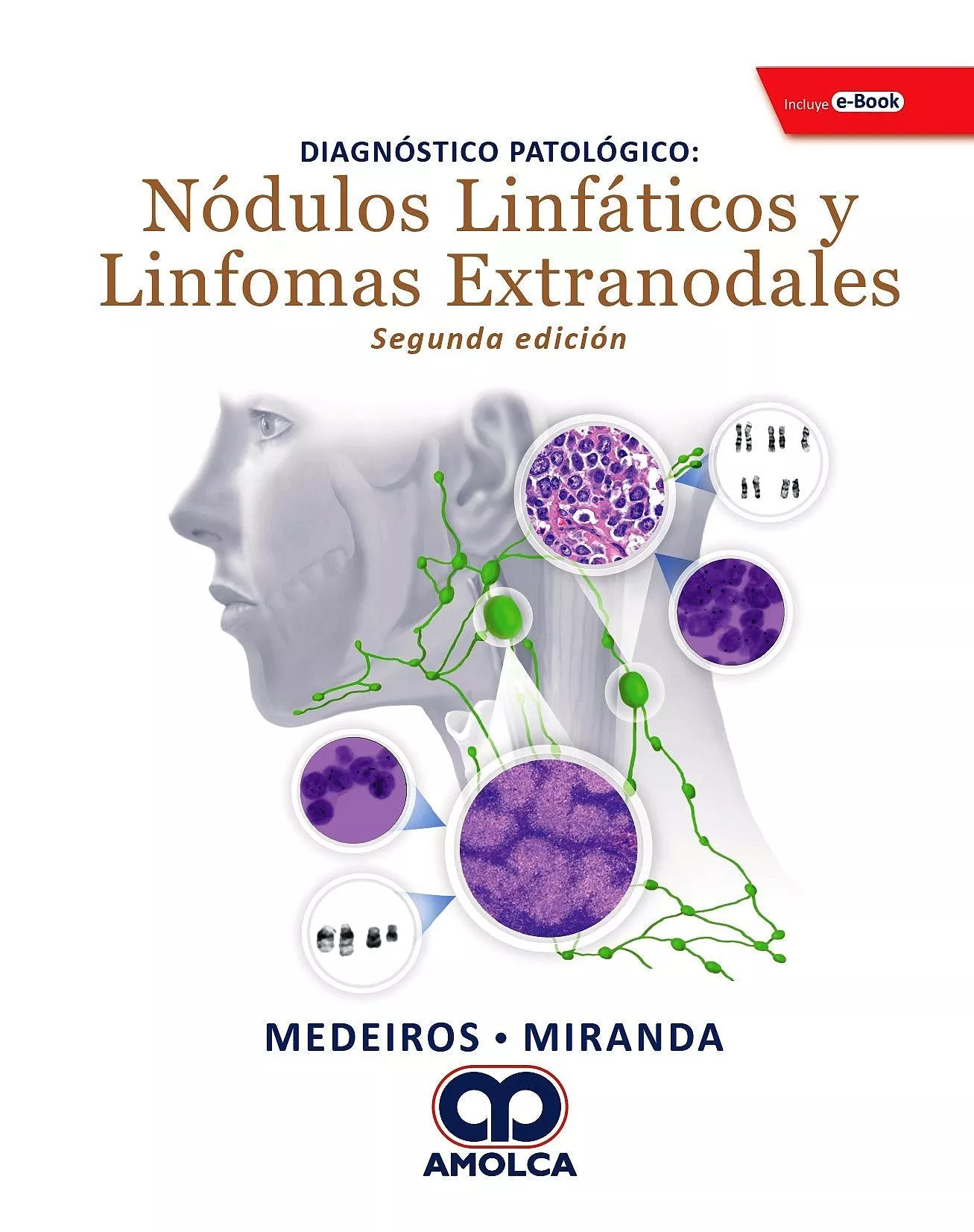 Portada del Libro Diagnostico Patologico. Nódulos Linfaticos Y Linfomas Extranodales + E de Jose Maria Miranda Boto - 9789804300851