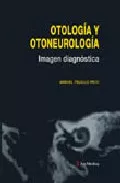 Portada del Libro Otologia Y Otoneurologia: Imagen Diagnostica de Manuel Trujillo Peco - 9788497511223