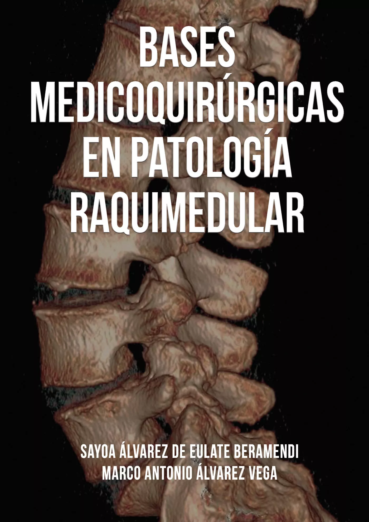 Portada del Libro Bases Medicoquirúrgicas En Patología Raquimedular de Marco Antonio Alvarez Vega - 9788417768645