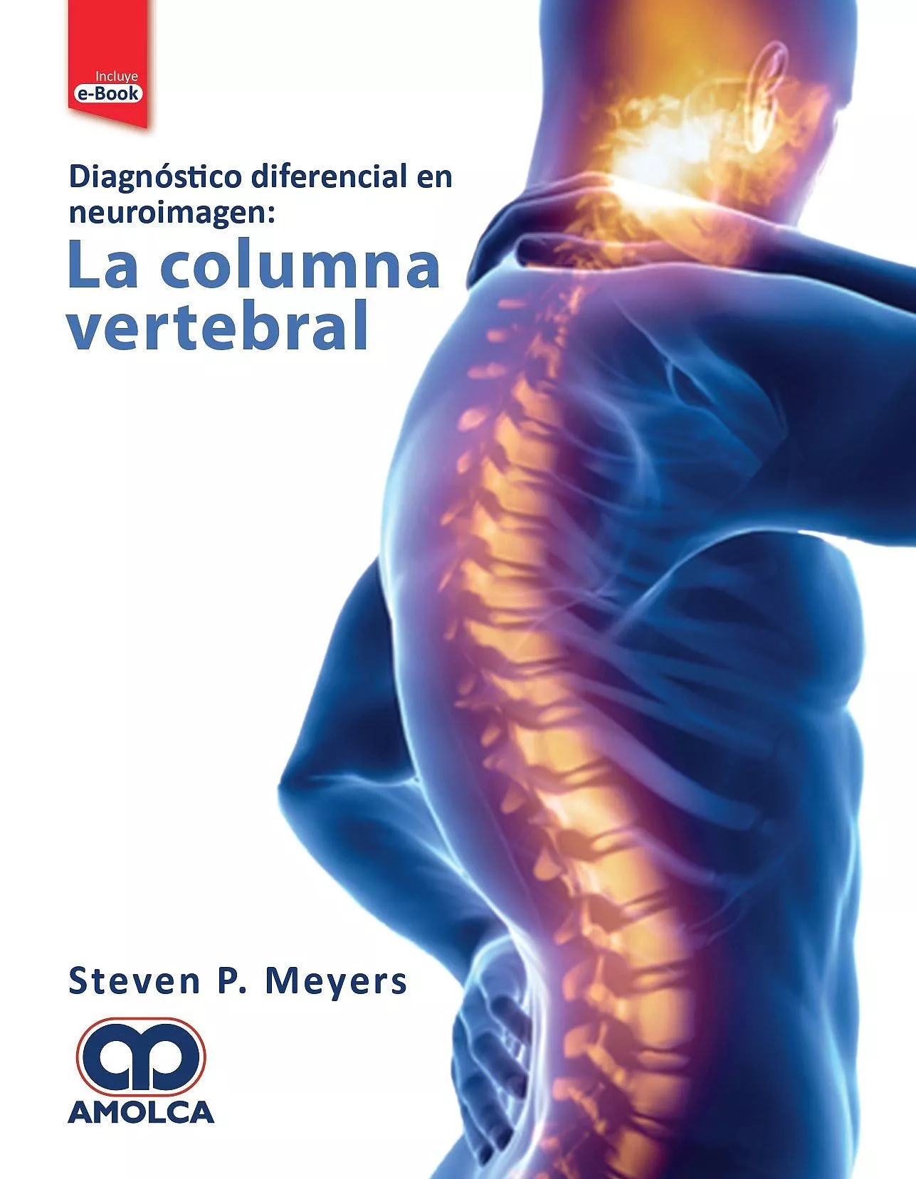 Portada del Libro Diagnostico Diferencial En Neuroimagen. La Columna Vertebral de Meyers - 9789804300004
