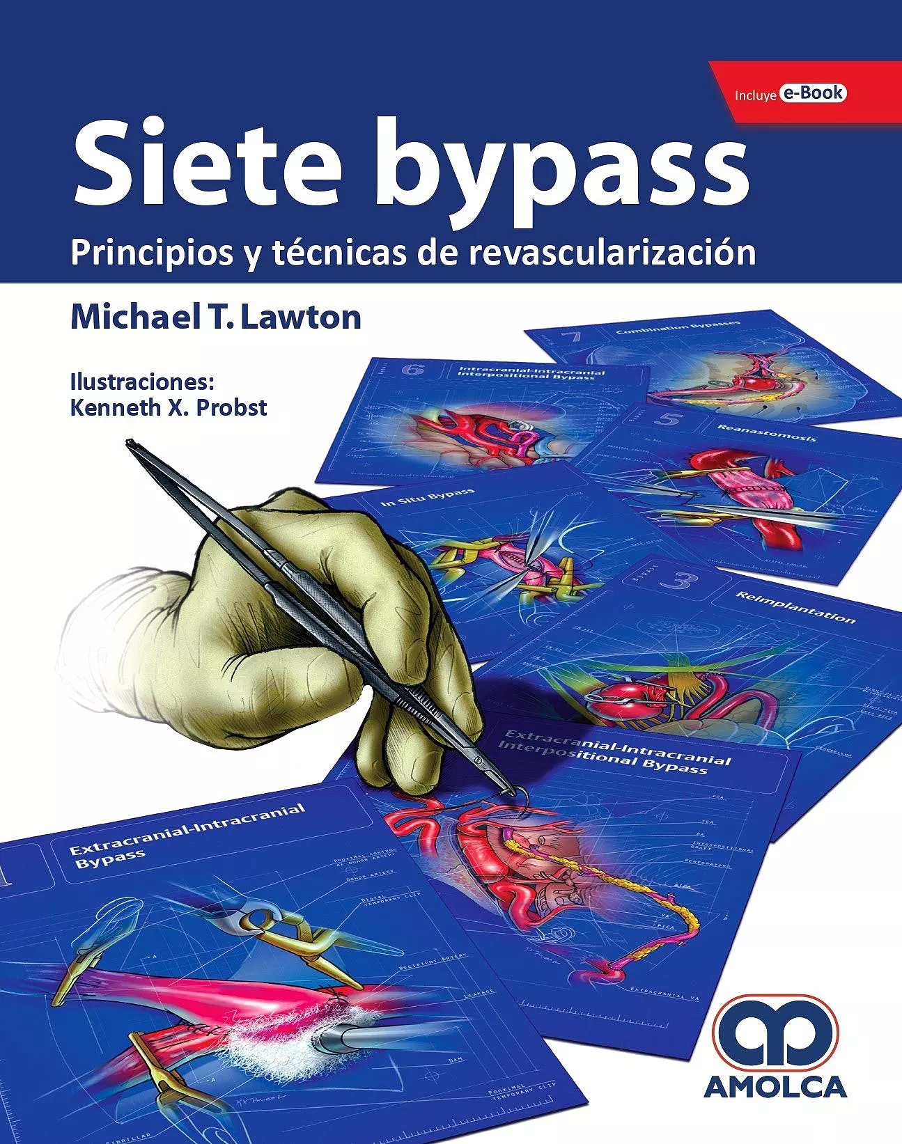 Portada del Libro Siete Bypass: Principios Y Tecnicas De Revascularizacion + E-Book de Michael T. Lawton - 9789804300813