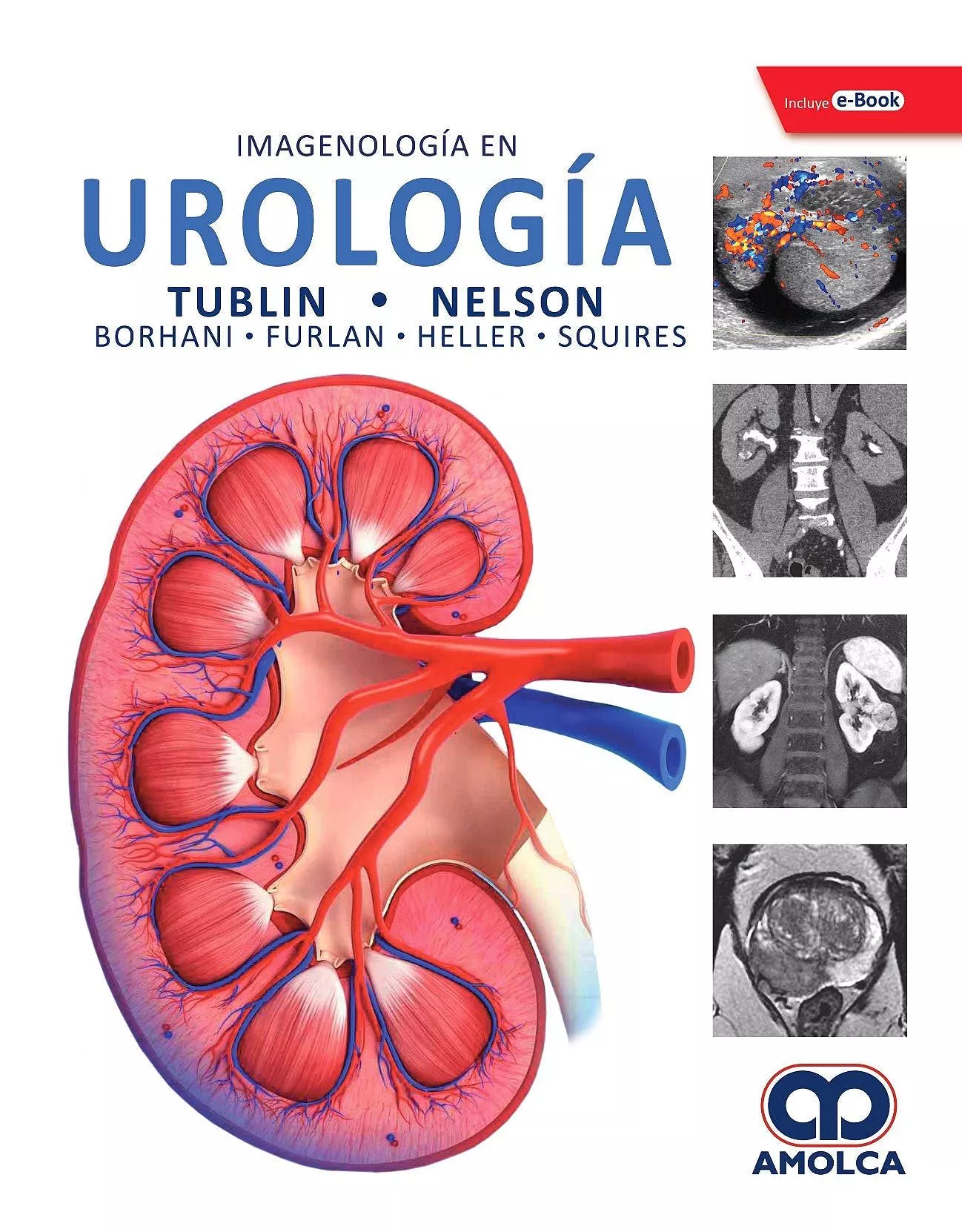 Portada del Libro Imagenologia En Urologia + E-Book de Nelson - 9789804301087