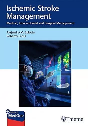 Portada del Libro Ischemic Stroke Management. Medical Interventional And Surgical Manage de Pereira - 9781626239081