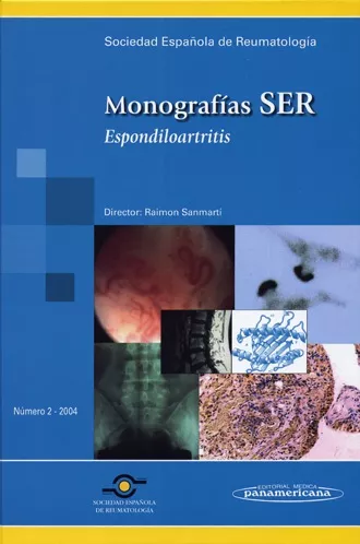 Portada del Libro Monografia Ser: Nº 2 (2004): Espondiloartritis de Ramon Sanmarti Sala - 9788479039059