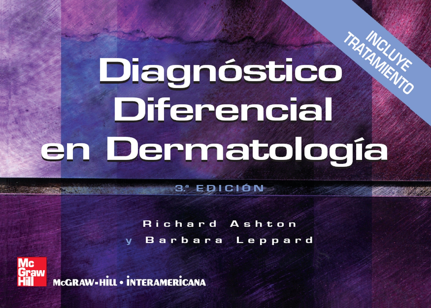 Portada del Libro Diagnostico Diferencial En Dermatologia de Richard Ashton - 9788448151638