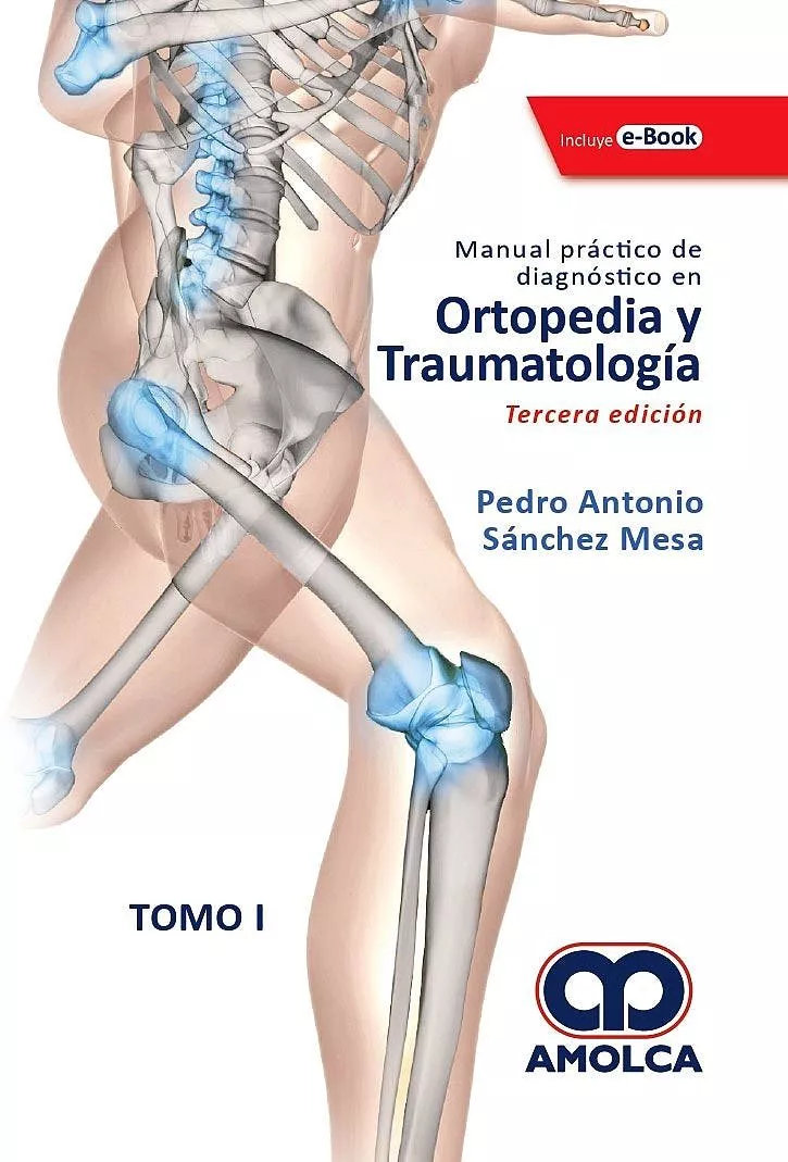 Portada del Libro Manual Practico De Diagnóstico En Ortopedia Y Traumatologia (2 Vols. + de Sanchez Mesa - 9789804300998