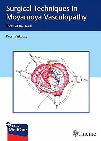 Portada del Libro Surgical Techniques In Moyamoya Vasculopathy. Tricks Of The Trade de Vajkoczy - 9783131450616