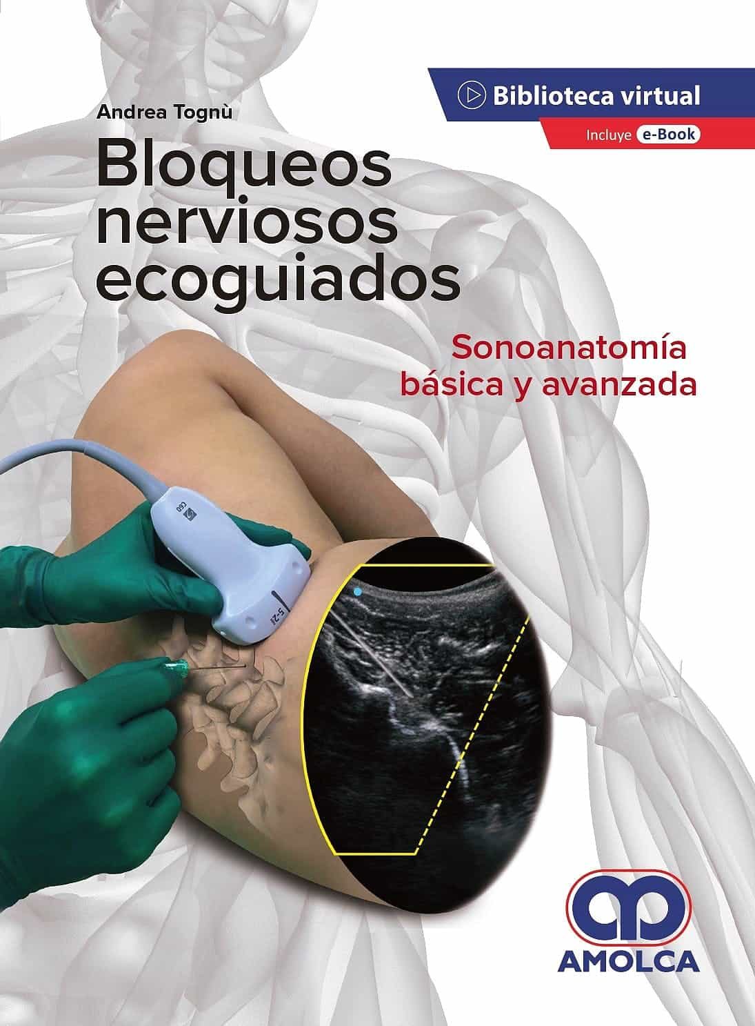 Portada del Libro Bloqueos Nerviosos Ecoguiados. Sonoanatomía Básica Y Avanzada de Vv.Aa. - 9789585598119