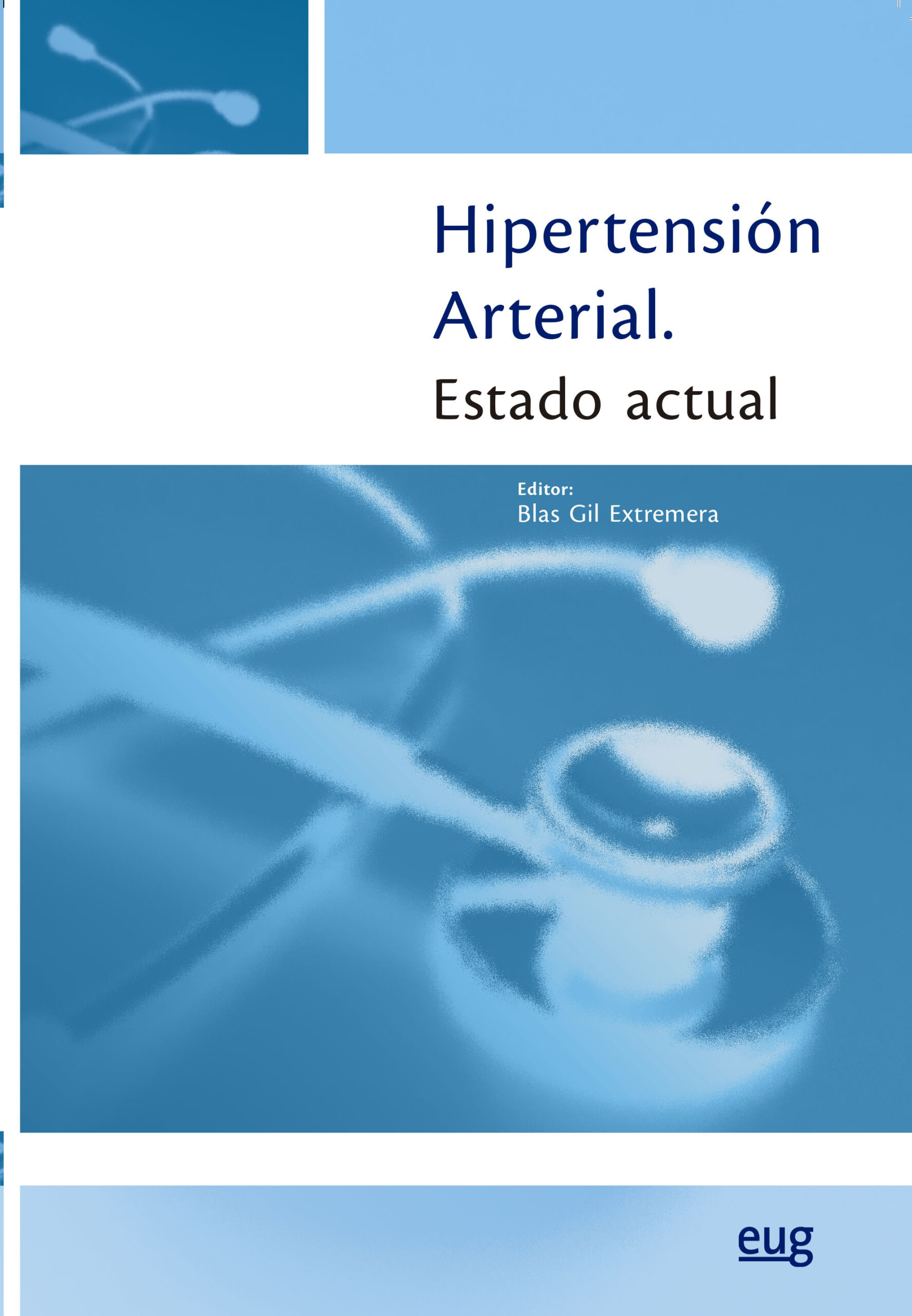 Portada del Libro Hipertensión Arterial. Estado Actual de Vv.Aa. - 9788433865397