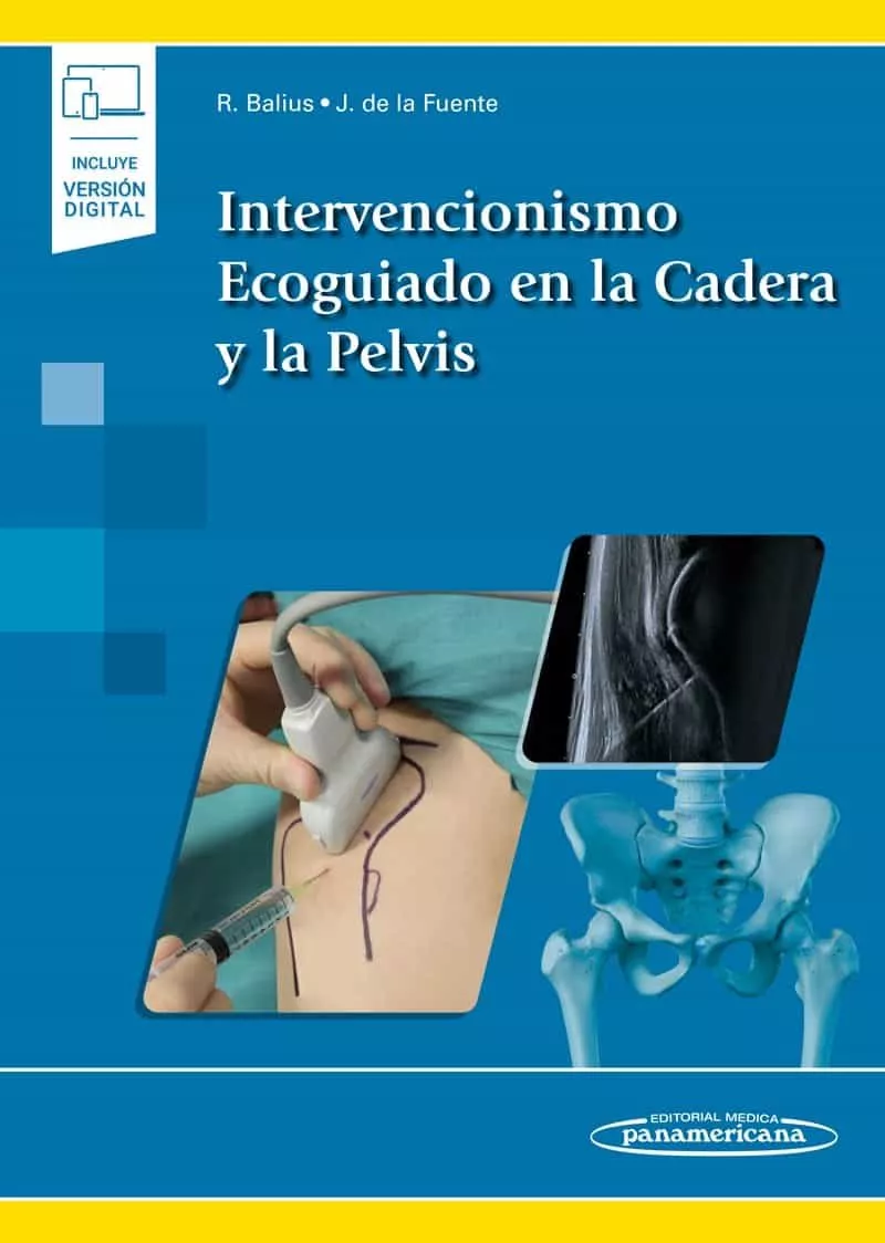 Portada del Libro Intervencionismo Ecoguiado En La Cadera Y La Pelvis (Incluye Versión D de Vv.Aa. - 9788491106753
