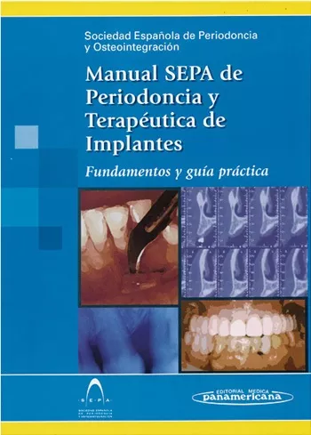 Portada del Libro Manual Sepa De Periodoncia Y Terapeutica De Implantes: Fundamento S Y de Vv.Aa. - 9788479038793
