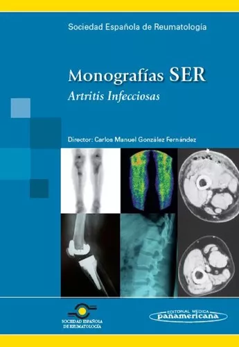 Portada del Libro Monografias Ser: Artritis Infecciosa de Vv.Aa. - 9788498351453