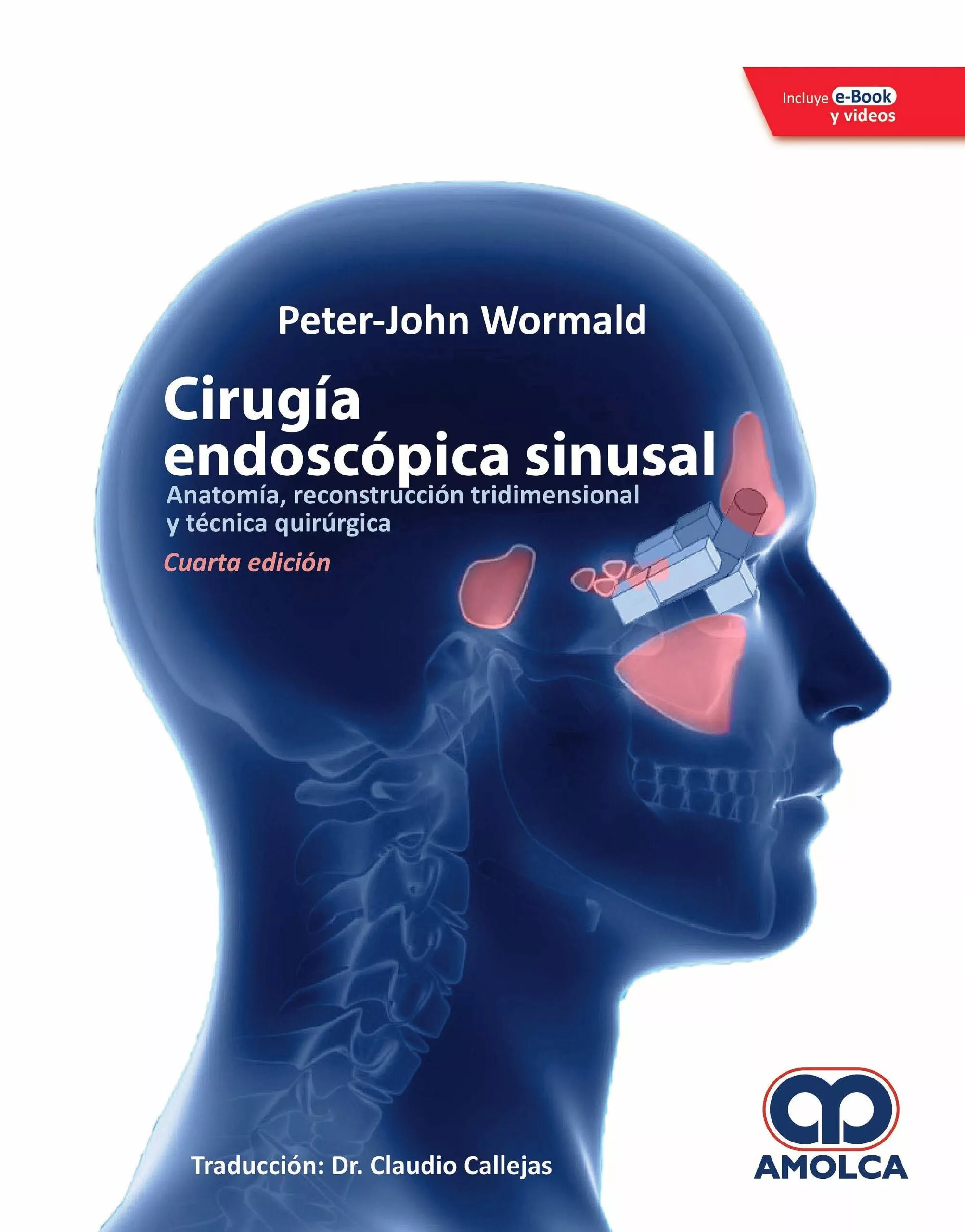 Portada del Libro Cirugia Endoscopica Sinusal: Anatomia Reconstruccion Tridimensional Y de Wormald - 9789804300172